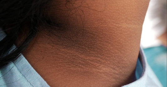 Dark Area Corrective Body Combo 2