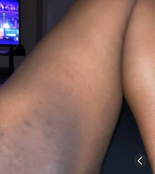 Dark Areas Corrective Body Combo 1